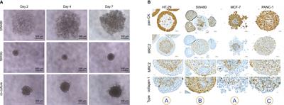 Architectural organization and molecular profiling of 3D cancer heterospheroids and their application in drug testing